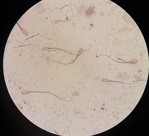 Sperm