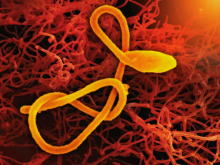 Ebola
