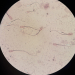 Sperm